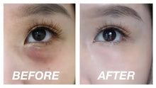 Load image into Gallery viewer, FILORGA M-HA10 PURE HYALURONIC ACID MESOTHERAPY