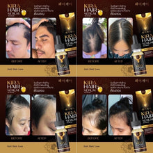 Load image into Gallery viewer, 6x KIRA HAIR SERUM hair growth concentrated formula Hair loss thinning gray 15ml