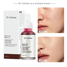 Load image into Gallery viewer, Red Mask for Clear Skin AHA MOOYAM AHA 30% BHA 2% Facial Care Product, Acne Treatment, Oil Control 30 ml.