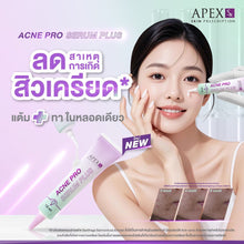 Load image into Gallery viewer, APEX-SX ACNE PRO SERUM PLUS: Concentrated serum to reduce acne 15 ml.
