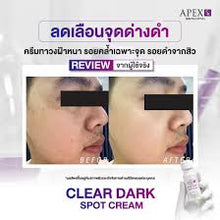 Load image into Gallery viewer, APEX-SX CLEAR DARK SPOT CREAM For fading Stubborn Dark Spots Such as Melasma, freckles, and acne scars. 15 ml.