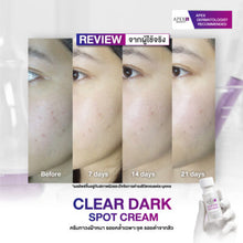 Load image into Gallery viewer, APEX-SX CLEAR DARK SPOT CREAM For fading Stubborn Dark Spots Such as Melasma, freckles, and acne scars. 15 ml.