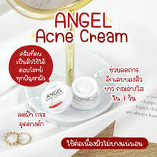 Load image into Gallery viewer, Angel Acne Cream: Whitens skin, reduces acne, acne scars, and dark spots.