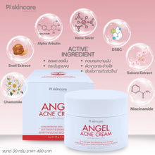 Load image into Gallery viewer, Angel Acne Cream: Whitens skin, reduces acne, acne scars, and dark spots.