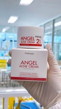 Load image into Gallery viewer, Angel Acne Cream: Whitens skin, reduces acne, acne scars, and dark spots.