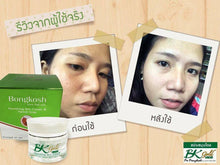 Load image into Gallery viewer, 5 x BK Gold Plus Bo Bongkoch Skin cream &amp; herbal soap acne, blemishes, freckles