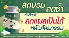 Load image into Gallery viewer, Number 1 best-selling dietary supplement for post-surgery recovery, by Sowon Clinic.