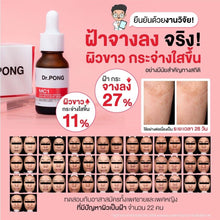 Load image into Gallery viewer, DR PONG MC1 Whitening Drone Melas Clear Serum Tranexamic acid Anti Melasma 16ml.