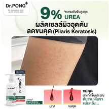 Load image into Gallery viewer, Dr.Pong BarrierX Body Butter Dermatitis Keratosis Pilaris Eczema Body Cream 300g