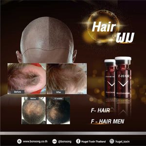 FUSION MESOTHERAPY F-HAIR 1 Box