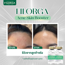 Load image into Gallery viewer, LABORATOIRES Paris FILORGA ACNE SKIN BOOSTER 5 Bottle