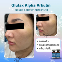 Load image into Gallery viewer, Glutax Alpha Arbutin 5% concentrated Serum to Treat Blemishes, Freckles, Acne, and Dark Spots