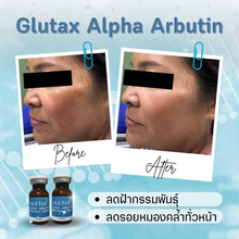 Load image into Gallery viewer, Glutax Alpha Arbutin 5% concentrated Serum to Treat Blemishes, Freckles, Acne, and Dark Spots