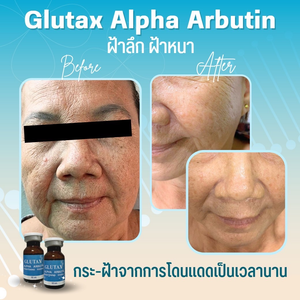 GLUTAX ALPHA ARBUTIN 5% BRIGHTENING ESSENCE WHITENING INJECTION