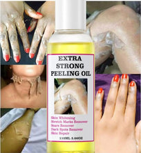 Load image into Gallery viewer, Peeling Oil For Dark Skin Super Strength Yellow Peeling Oil Strong Peeling Oil For Skin Brightening Moisturizing Removes K6V1