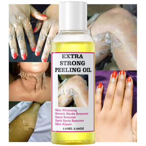 Peeling Oil For Dark Skin Super Strength Yellow Peeling Oil Strong Peeling Oil For Skin Brightening Moisturizing Removes K6V1