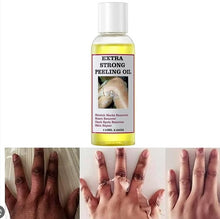 Load image into Gallery viewer, Peeling Oil For Dark Skin Super Strength Yellow Peeling Oil Strong Peeling Oil For Skin Brightening Moisturizing Removes K6V1