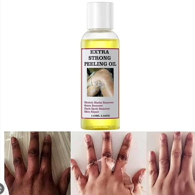 Peeling Oil For Dark Skin Super Strength Yellow Peeling Oil Strong Peeling Oil For Skin Brightening Moisturizing Removes K6V1