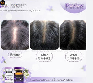 INNO HAIRA Reduce hair loss as desired with the best quality assistant.