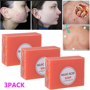 KOJIC Acid Face Body Cleanser Soap for Dark Spots Skin Lightening & Whitening