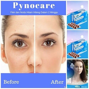 Pynocare Whitening Melasma Hyperpigmentation supplements Nourishing Skin Care