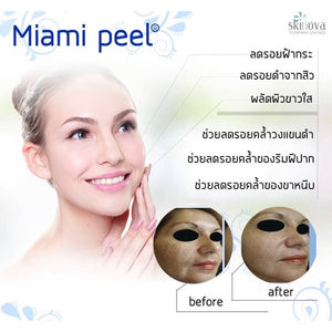 Miami peel 7.5 ml reduces blemishes, freckles, clear face  Original 7.5 ml 1 Pcs