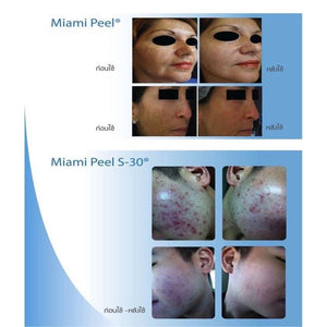 Miami peel 7.5 ml reduces blemishes, freckles, clear face  Original 7.5 ml 1 Pcs