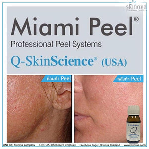 Miami peel 7.5 ml reduces blemishes, freckles, clear face  Original 7.5 ml 1 Pcs