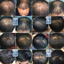 Load image into Gallery viewer, Pure Hair 15% Hair Loss and Thinning Hair Serum 30 ml.
