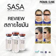 NEW SASA LIPOLYTIC SOLUTION SASA came up with a new formula. Easy to use