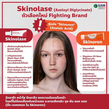 Load image into Gallery viewer, SKINOLASE reduces melasma effectively, no need to worry about thinning skin. Imported from Korea, 35 g.