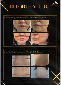 SS Firming (received Thai FDA and Korean FDA)(whole box 5 bottles)