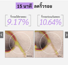 Load image into Gallery viewer, Spring Letter Toner Pad: Portable VC toner pads that reduce wrinkles, firm the skin, increase elasticity,