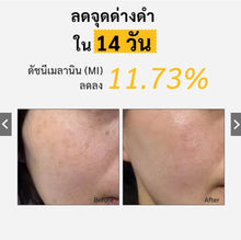 Load image into Gallery viewer, Spring Letter Toner Pad: Portable VC facial pads that reduce dark spots, brighten skin, and fade freckles