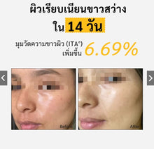 Load image into Gallery viewer, Spring Letter Toner Pad: Portable VC facial pads that reduce dark spots, brighten skin, and fade freckles