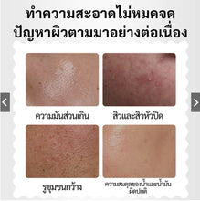 Load image into Gallery viewer, Spring Letter Facial Wipes with 2% Salicylic Acid, travel size. Controls oil, exfoliates