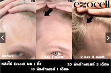 Load image into Gallery viewer, Exocell X1 - Thai FDA and Korean FDA Approved. Pure, Fresh Stem Cells (10 billion cells) for Hair