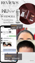 Load image into Gallery viewer, Exocell X1 - Thai FDA and Korean FDA Approved. Pure, Fresh Stem Cells (10 billion cells) for Hair
