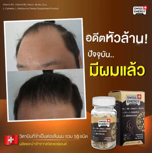 Swiss Energy HN&S (Hair, Nail, Skin) new innovation in vitamin form for hair loss