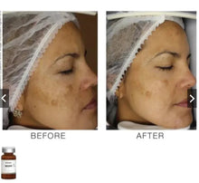 Load image into Gallery viewer, TOSKANI WCPR (Whitening Complex Poli Revitalizing) 1 Box Full Set