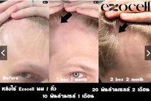 Load image into Gallery viewer, [S+tool+6866] Exocell X1 Thai FDA, Korean FDA approved. Pure, fresh stem cells