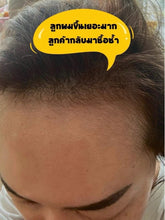 Load image into Gallery viewer, [S+tool+6866] Exocell X1 Thai FDA, Korean FDA approved. Pure, fresh stem cells