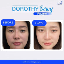 Load image into Gallery viewer, Dorothy Dewy skin filler from Korea: Great price, bouncy skin, repeat purchases