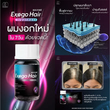 Load image into Gallery viewer, exogo hair treatment, hair nourishing injection from Korea The shadow bounces until friends greet you
