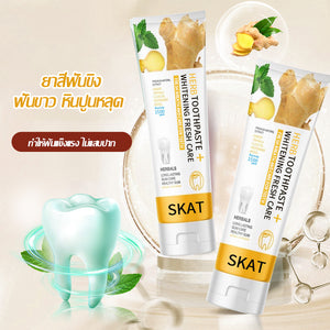 Ginger Toothpaste White Teeth Bad Breath Whitening Teeth Braces Yellow Teeth Beyond Khing Teeth