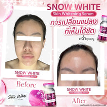 Load image into Gallery viewer, Snow White Skin Whiening Serum 1 Box full of water, glass skin