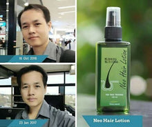 Load image into Gallery viewer, 10X Neo Hair Lotion Root Original Nutrients Longer Hair Treatment 120 ml. Best Selling