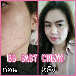 6 Box BB Cream Baby Facial Cream Set Best Reduce Acne Age Spot Remover Skin Care 5g