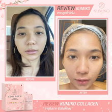 Load image into Gallery viewer, 6 X 15 Premium Kumiko Collagen Anti-aging Skincare Moist Smoot Natural Brighten