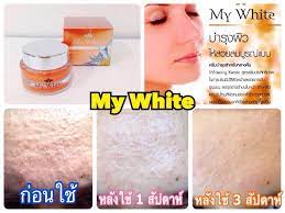 My White Night Cream Natural Anti Aging Acne Spot Freckle Dark Spot Skin Keratin